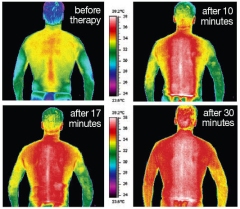 thermal image - far infrared heat effects